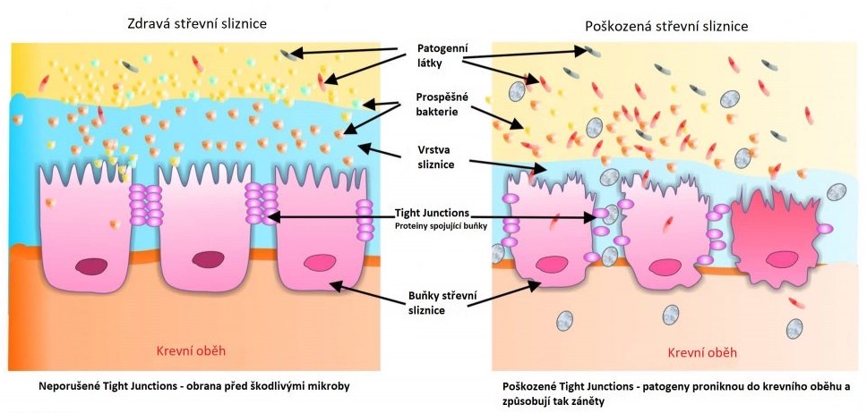 Zdravá a porušená střevní sliznice
